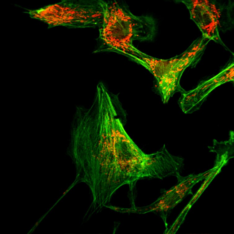 Stained Bovine Pulmonary Artery Endothelial (BPAE) cells